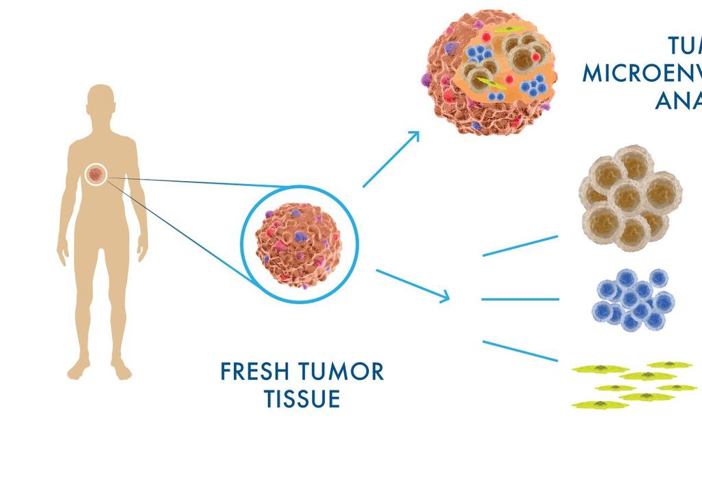 Cell-Match: In vitro drug testing and biomarker discovery with autologous patient-derived cell lines TUMOR MICROENVIRONMENT ANALYSIS TUMORCELLS TUMOR INFILTRATING LYMPHOCYTES (TIL) FRESHTUMOR TISSUE