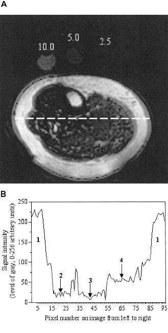 Fat-selective magnetic resonance image of the lower leg Goodpaster, B. H et al.