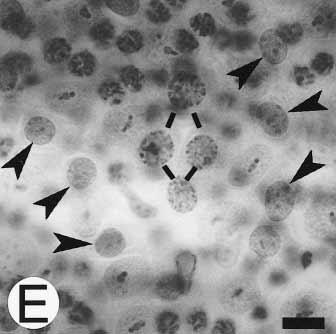 de Rooij and Russell Spermatogonia 781 Figure 8G. A 1 spermatogonia (arrowheads). Magnification 1320. Bar 10 m. Figure 8E.