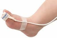 Pulse oximetry as screening method - Pulse oximetry measures the amount of O 2 Hgb in the arterial blood