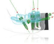 All components are made to work together from plan ning in NobelClinician Software to guided implant surgery with ready-to-use surgical template and tailored guided surgery kits.