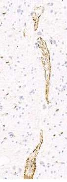 right antibody Appendix Appendix - ALK Tissue with low epitope expression to assure the sensitivity: