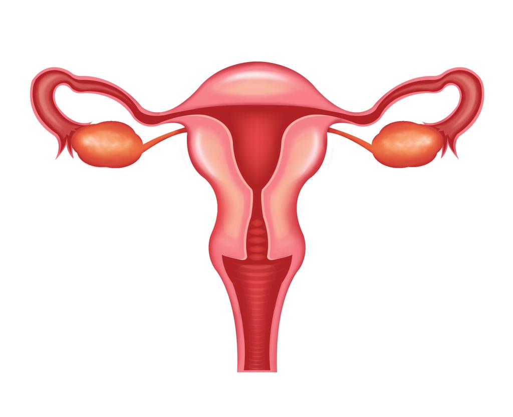 Hysterectomies are performed to treat many medical conditions Most hysterectomies done in the US are for women diagnosed with uterine fibroids.