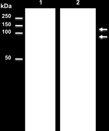 Run the gel at a constant voltage between 125-200 volts until the dye front is near the bottom of the gel. D. Peptidoglycan hydrolase detection 1.