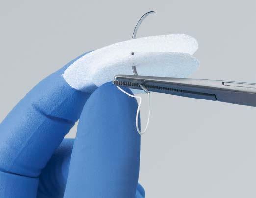 SIZING 2 Sizing SYNPOR Implants can be easily cut and sculpted with scissors, mesh cutters, or a