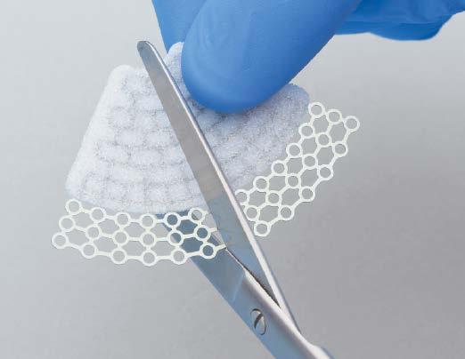 After sizing the implant, rinse it in sterile saline solution to remove loose particles.