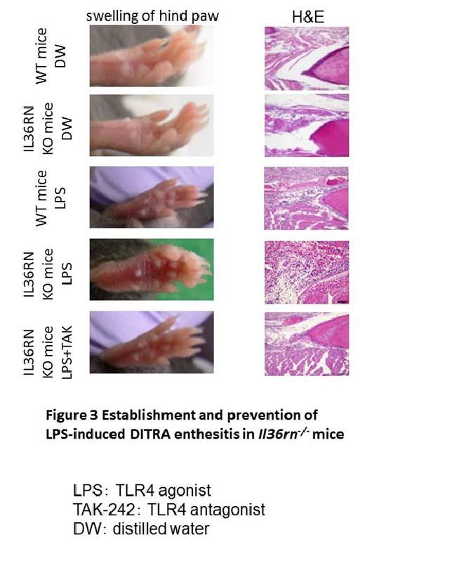 Research Summary and Future Perspective Via TLR4-signaling activation, we established a model of the systemic autoinflammatory symptoms of DITRA, the cutaneous, hepatic, and articular lesions in