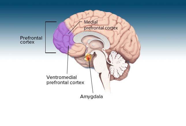 Prefrontal Cortex Pre Frontal Cortex Role Complex thinking, Decision making Appropriate behavior PTSD Reduced Activity/Volume