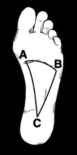 strike in supination