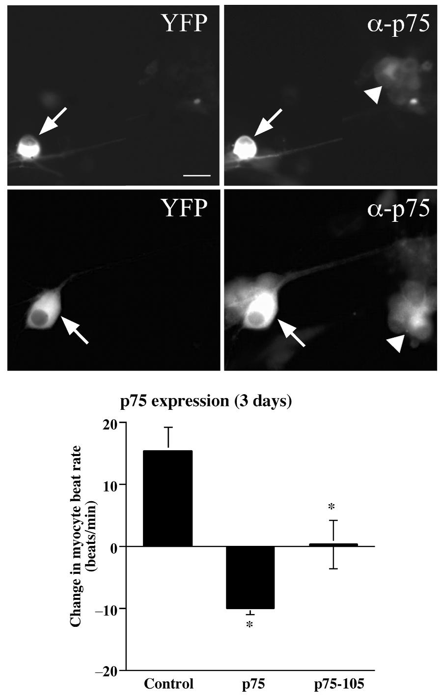 Fig. 5. Overexpression of the p75 receptor induced inhiitory neurotrnsmission.