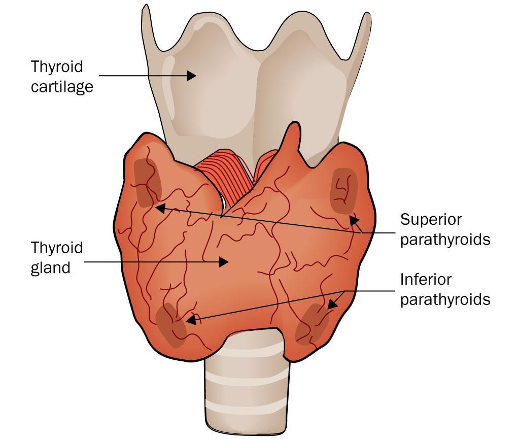 Thyroid tumors Papillary ca. (up to 80%) Follicular ca.