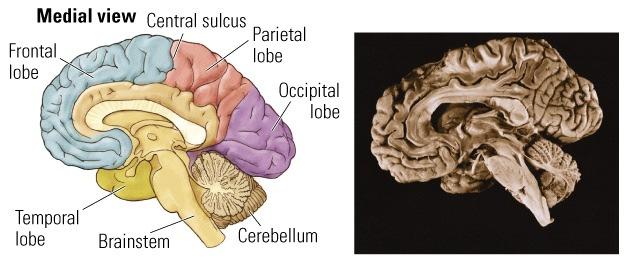 Cerebral