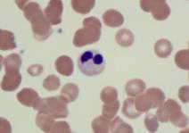 Cell Transplantation Examples from the Lab Low Blood Counts 71