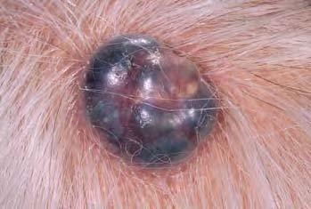 Clinical diagnosis of malignant melanoma can be difficult, as the differential diagnosis is wide, and includes nevi, seborrheic keratosis, dermatofibroma, pyogenic granuloma (Figure 3.