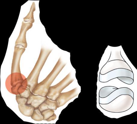Types of Synovial Joints Pivot/trochoid