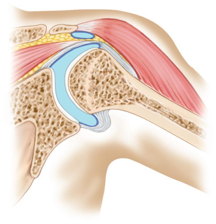 Shoulder Joint Ball-and-socket Head of humerus and glenoid cavity of scapula Loose joint capsule Bursae Ligaments prevent displacement Very wide range of
