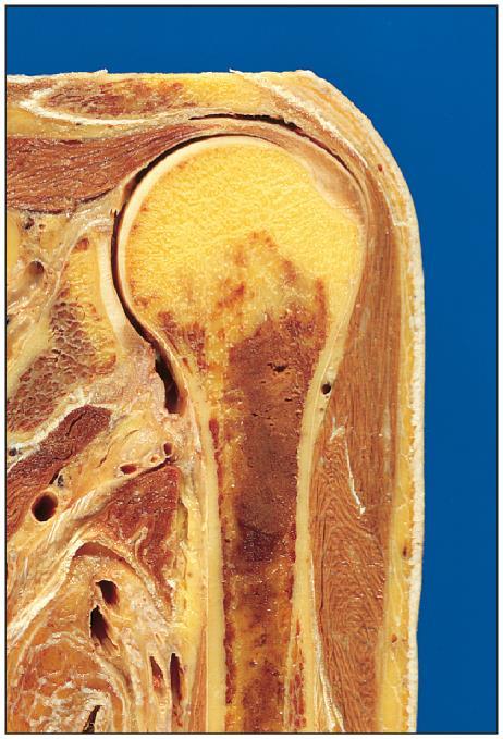 Shoulder Joint Joint capsule Joint cavity Head of humerus Articular cartilage Scapula Humerus Acromion process