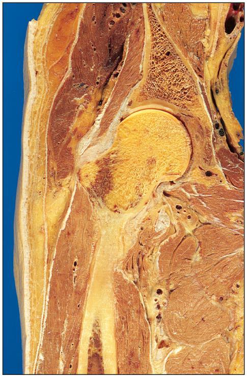 Hip Joint Hip bone Ilium Ilium Articular cartilage Joint