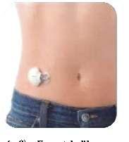 Freestyle Libre Pro is also referred to as flash glucose monitoring system (FGM). It has no alarms hence and can overcome alarm fatigue seen with 23 conventional CGMs.