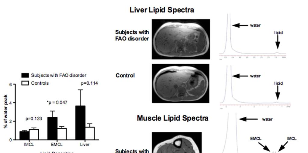Liver and Muscle Lipid