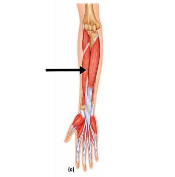MCP, PIP and DIP flexion, wrist flexion Flexor Pollicis Longus Middle anterior portion of the radius and