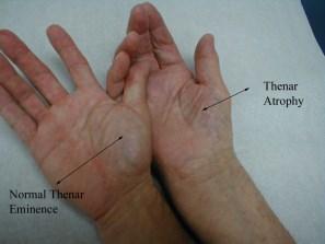 Special Structures in the Hand