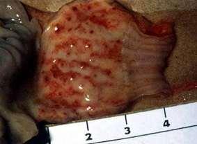 Hemorrhagic internal lesions Tracheal