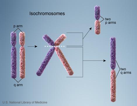 An isochromosome is an abnormal chromosome with two identical