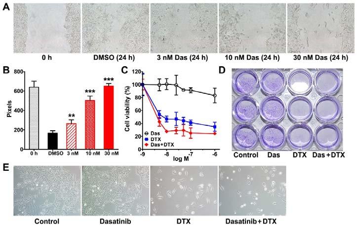 Supplemental Figure 5. Dasatinib inhibited A549-fLuc tumor cell migration but had limited cytotoxicity compared to docetaxel (DTX).