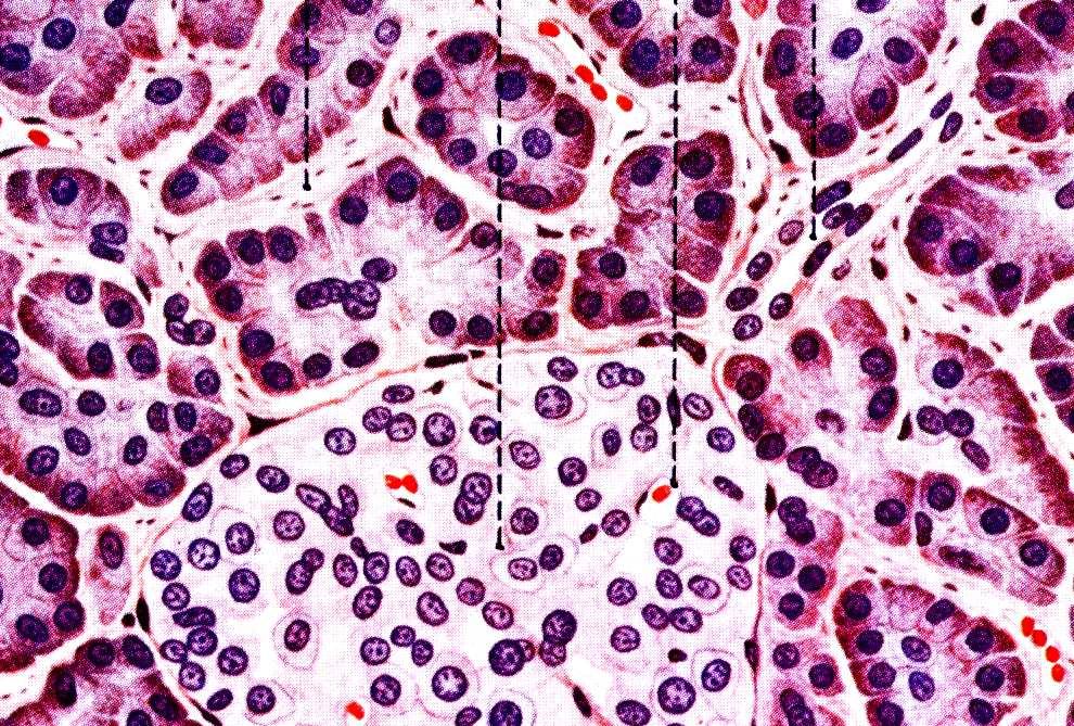 Ito cells (EM 61).
