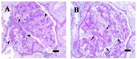 (Fig. 3). In female SDT fatty rats, a qualitatively equal change was observed in histopathological findings of kidneys [4].