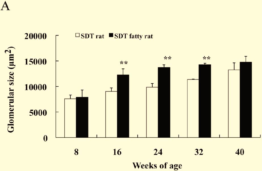 Spontaneously Diabetic Torii Lepr fa (SDT Fatty) Rat The Open Diabetes Journal, 2011, Volume 4 33 Fig. (4). Changes of glomerular size in male rats (A) and female rats (B).