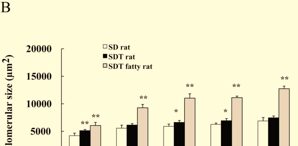 Data shown as mean ± SD (male rats;n=3-4, female rats;n=5). *P<0.05, **P<0.01; significant difference from SDT rat (male rats) or SD rats (female rats). Fig. (5). Histological analysis of lens.