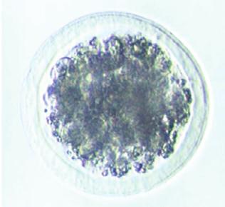 Following the FSH doses, embryos in all stages were harvested, from compact morulas, to blastocysts, and to a small number of unfertilized oocytes resulting from a late ovulation.
