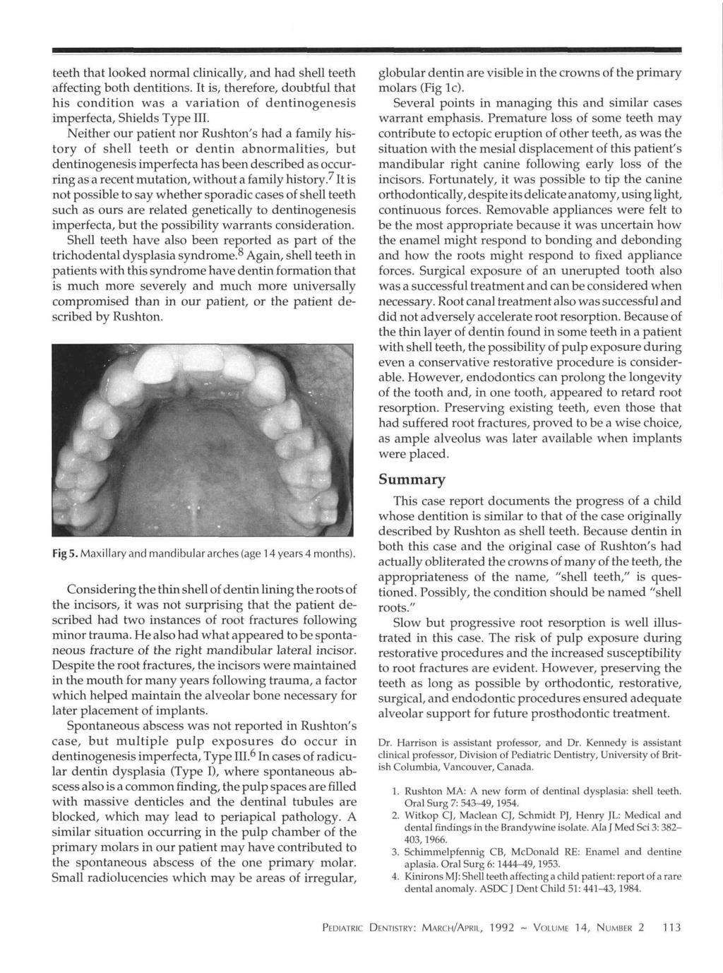 teeth that looked normal clinically, and had shell teeth affecting both dentitions. It is, therefore, doubtful that his condition was a variation of dentinogenesis imperfecta, Shields Type III.