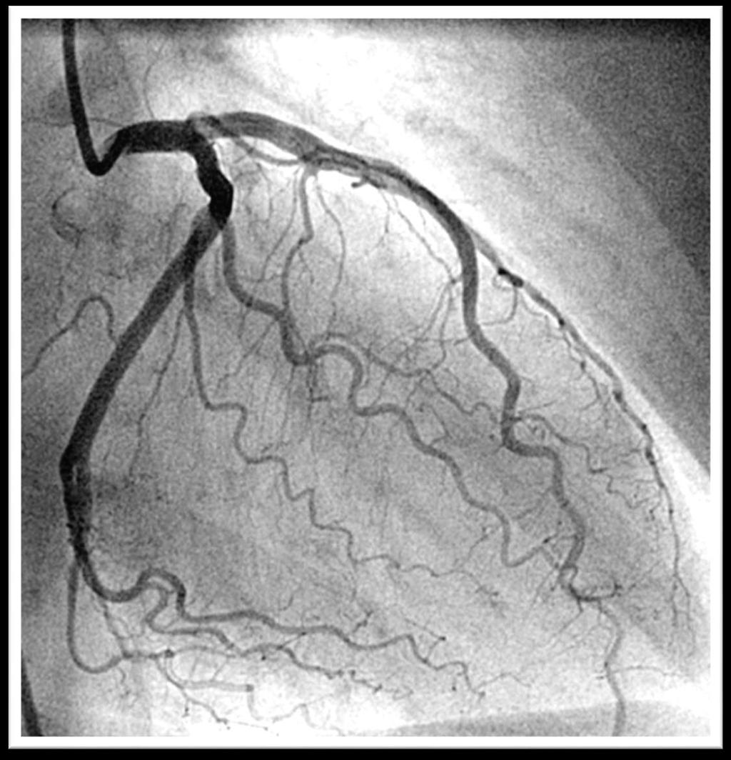 Services Provided Invasive Cardiac Diagnostic Procedures and Interventions Selective coronary arteriogram (SCA) Graft Revisualization Right Heart Catheterization