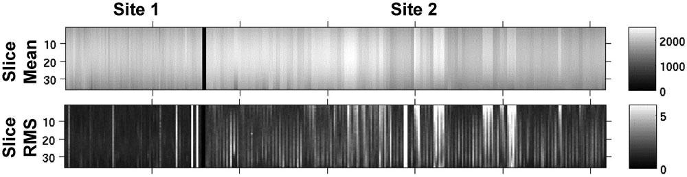 24 Sutton et al. Figure 1. Phantom quality control runs at both sites, showing the mean and noise properties across all 36 slices of the QA acquisitions.