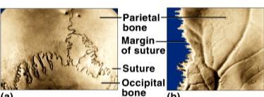 bones amphiarthrotic (slightly movable) distal ends of tibia and fibula radius and ulna broad sheets