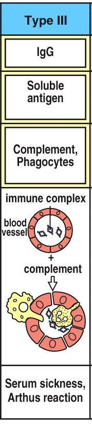 Type III Hypersensitivity Immune complexes are formed when antibody binds with antigen;