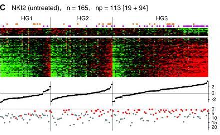 correlates with prognosis G1 and G3 tumor show different gene expression profiles These profiles (genomic grade