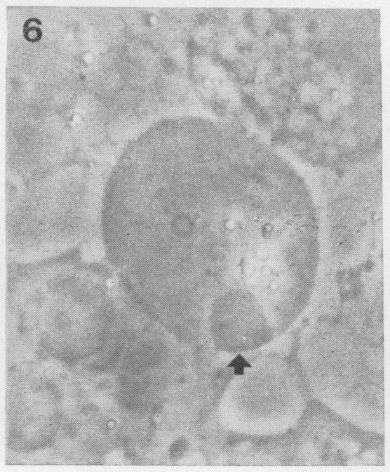 A dividing primary spermatocyte Fig. 5.