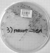 Bronchoalviolar lavage (BAL) Label 2 plates each BAP, EMB/MAC, chocolate Vortex 30-60 sec Gram stain 1 drop of unspun sample Transfer 0.1 ml (100 µl) BAL into 0.9 ml TSB Vortex to mix Plate 0.