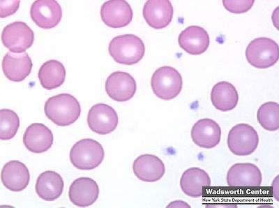 Platelets Anuclear cell fragments, contain cytoplasm and proteins (4 µm