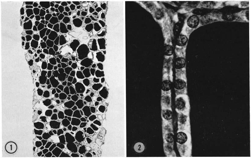 FIGURES 1 and 2 Cross-section of a slice of dog thyroid which had been incubated in vitro. Controls. PAS-hematoxylin. Fig. 1, incubated for 1 hr. Preservation of colloid good.
