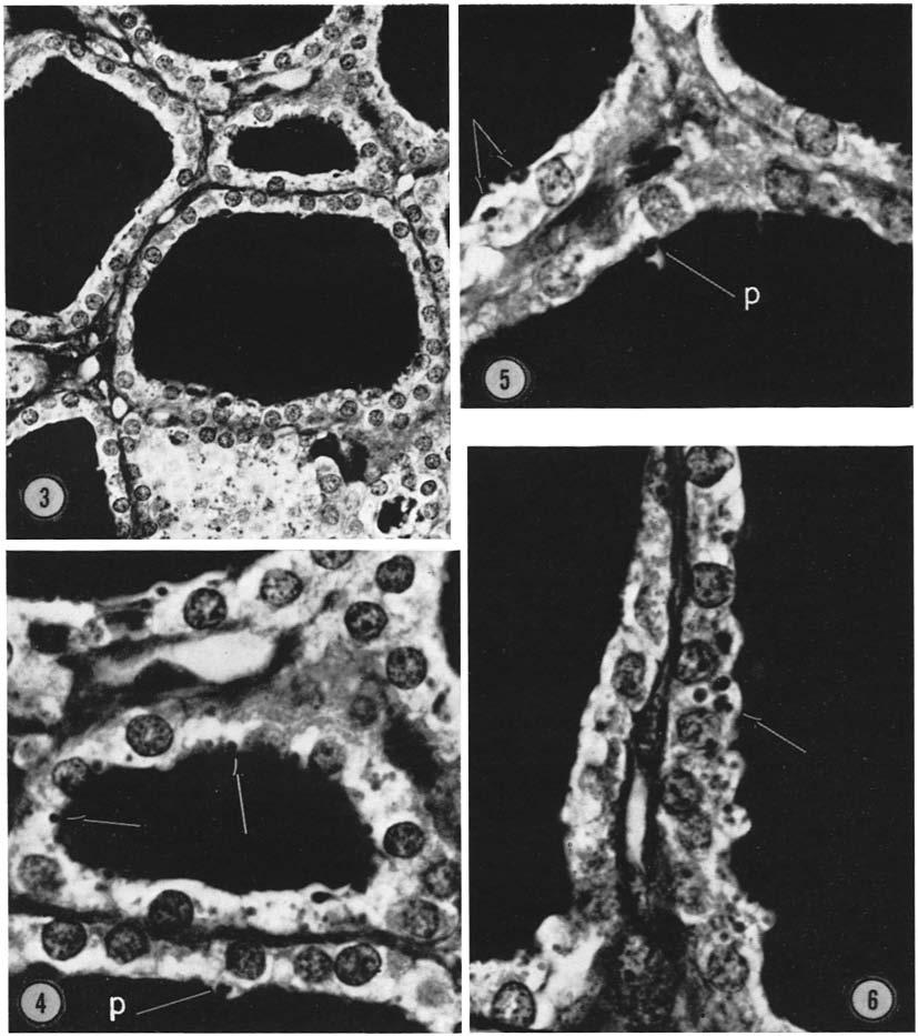 Note the irregularities in the apical membranes and the numerous tiny droplets in epithelial cells of follicles and in the tangential section of the follicle at the bottom of the figure.