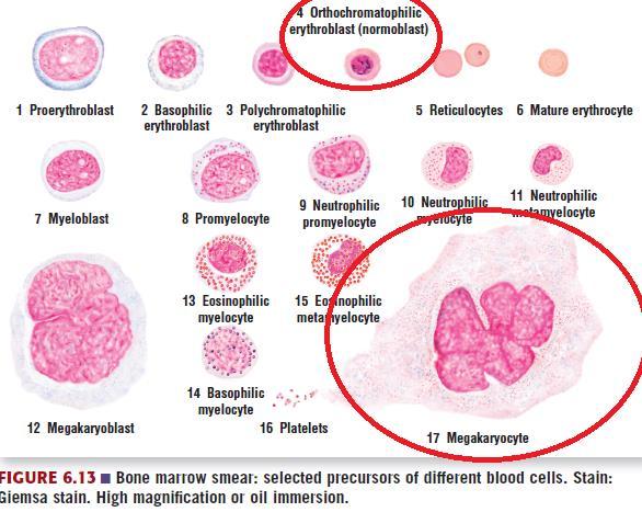 Orthochromatophilic Erythroblasts (Normoblasts) Most recognizable