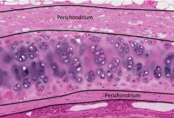 Perichondrium Perichondrium can be found around the perimeter of elastic cartilage and hyaline cartilage. Fibrocartilage and articular cartilage both lack perichondrium.