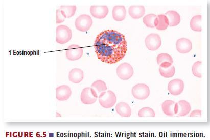 Eosinophils Eosinophils: Are phagocytic cells with a particular affinity for antigen antibody complexes that