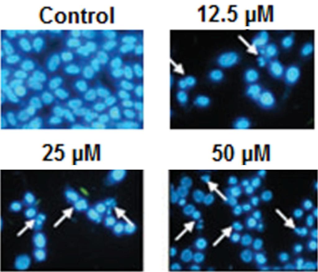 The Hep-G2 cells were treated with beta-amyrin at varied concentrations.