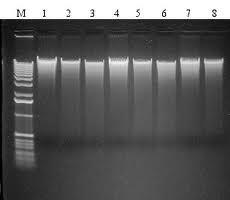 Workflow Sample DNA
